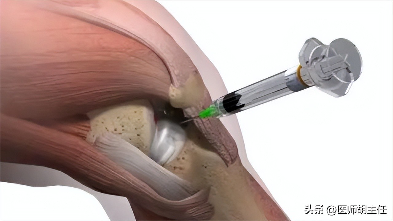封闭针能立即止痛吗,打了封闭针韧带还能恢复吗