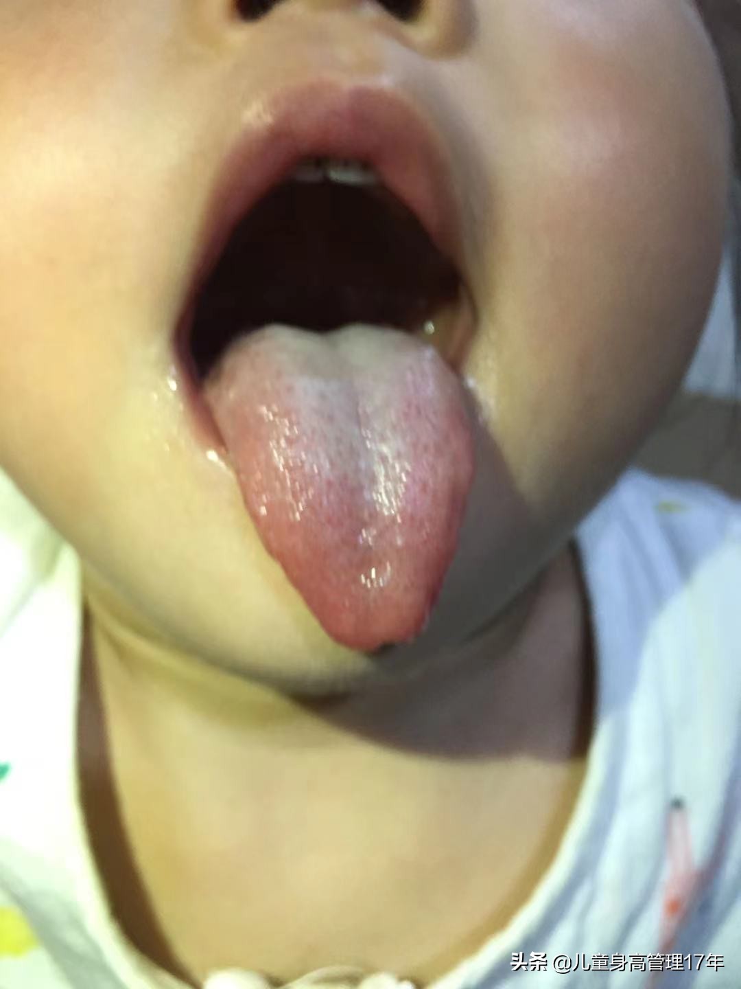 孩子长个慢的原因有哪些,孩子不长个是怎么回事