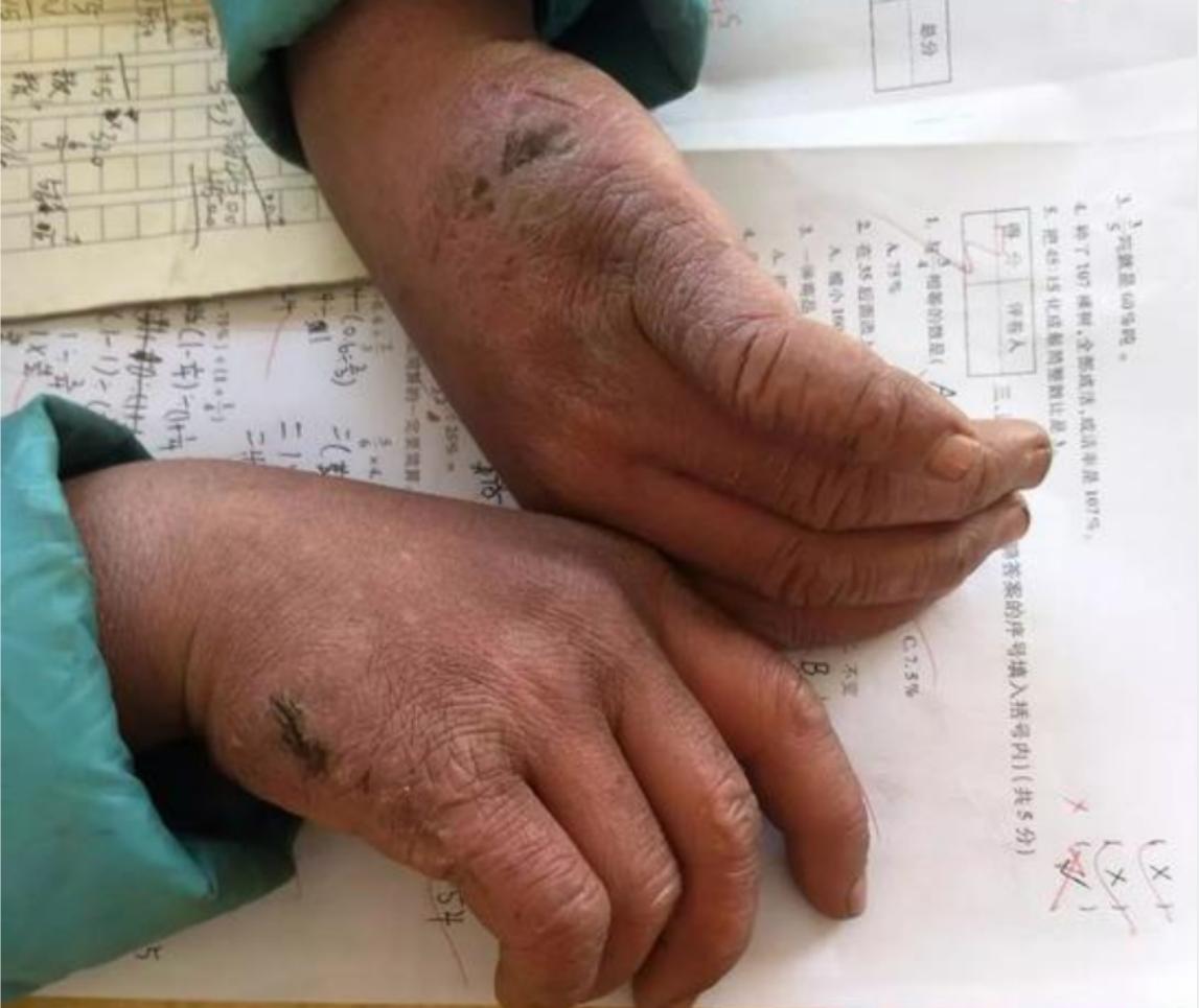 3岁被冻的孩子现在怎么样了,小男孩被冰冻三百年