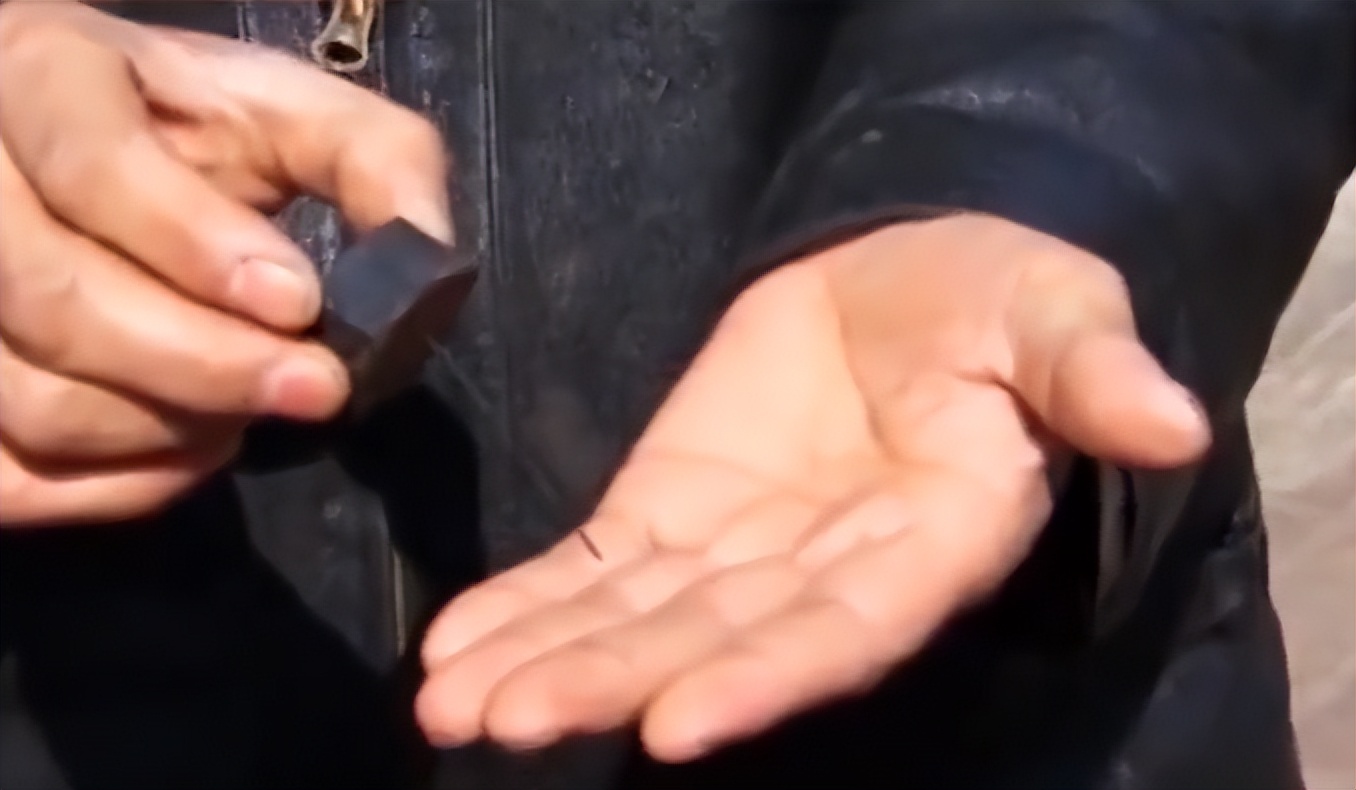 17岁男孩头痛被送进医院，医生一看X光片直接傻眼：没救了