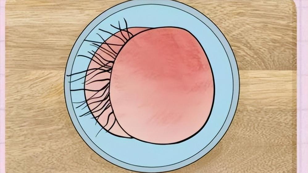 女性屁股上长满痘痘什么原因,女性臀部前面生毛怎么消除