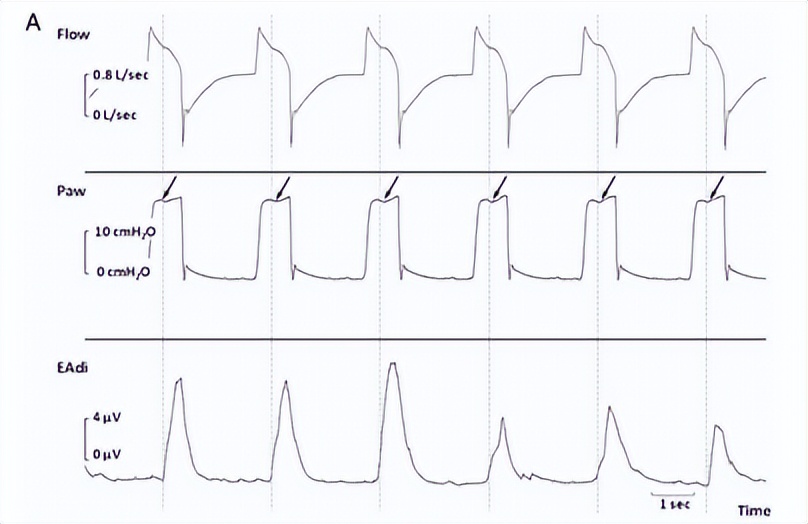 罗红教授,机械通气波形分析和临床应用