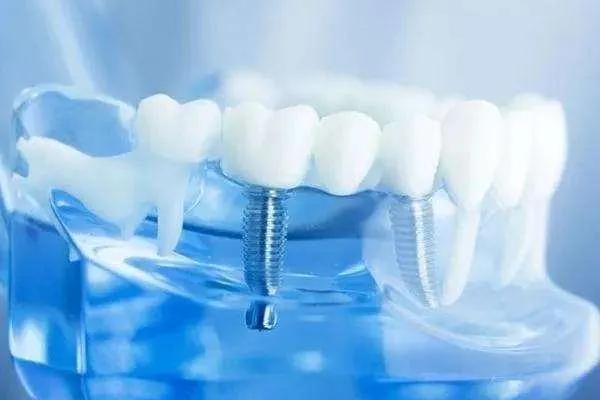 假牙骗局揭秘视频,假牙暴利的秘密