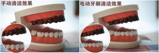 使用电动牙刷的好处与坏处,长期使用电动牙刷的危害弊端