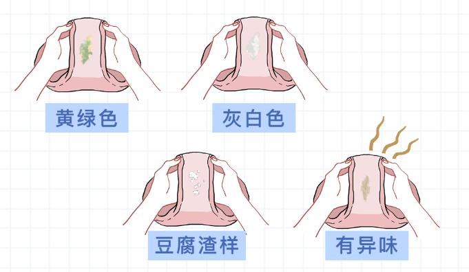 妇科常识知识大全图片,女生必须知道的7条妇科常识