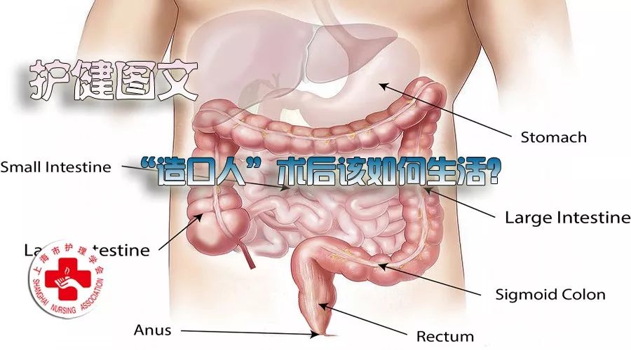 造口人术后怎么护理,造口护理的健康宣教