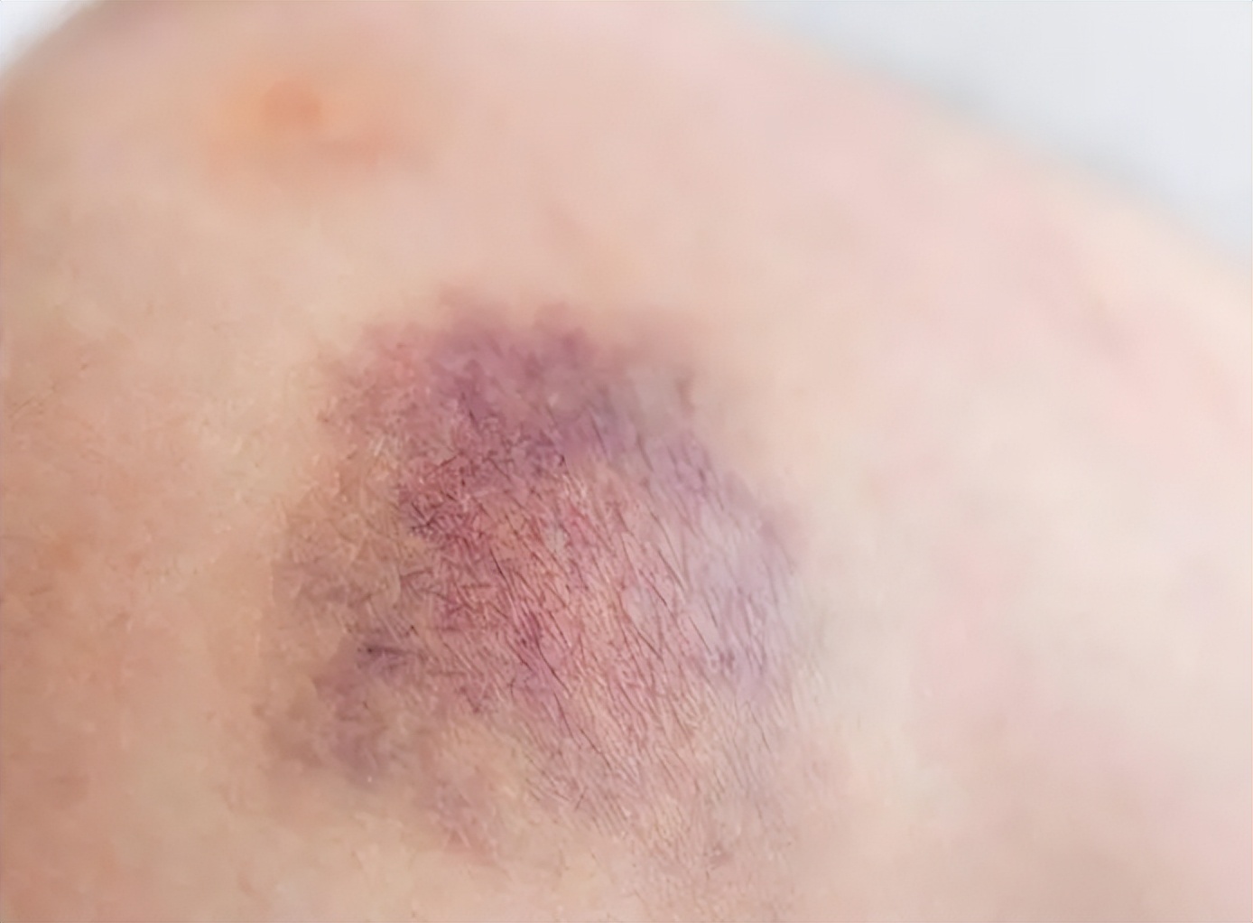 肺癌患者如何拥有更长的生存期,肺癌患者为什么身体状况忽好忽坏