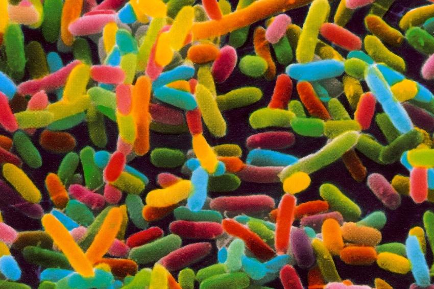 女生身体这处有异味要当心,女性异味太重可能诱发哪些疾病