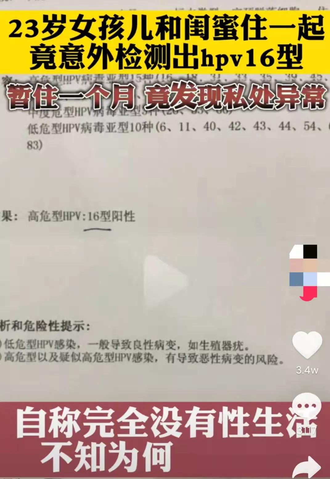 23岁女子被感染艾滋病,23岁被女朋友传染艾滋病