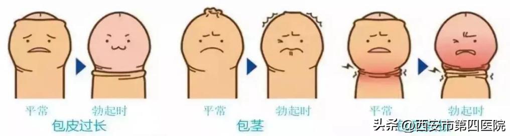 健康素养提升行动,健康素养水平提升行动