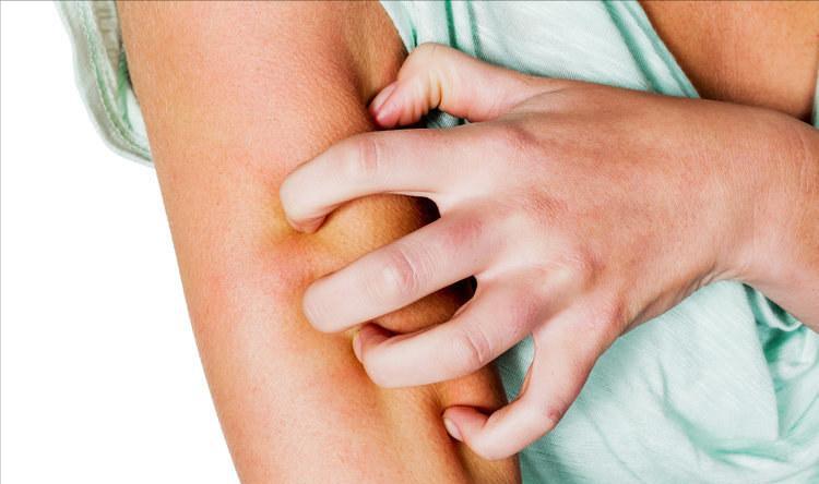 孩子眼睛长阴虱怎么处理,阴虱长在小孩眼睫毛上