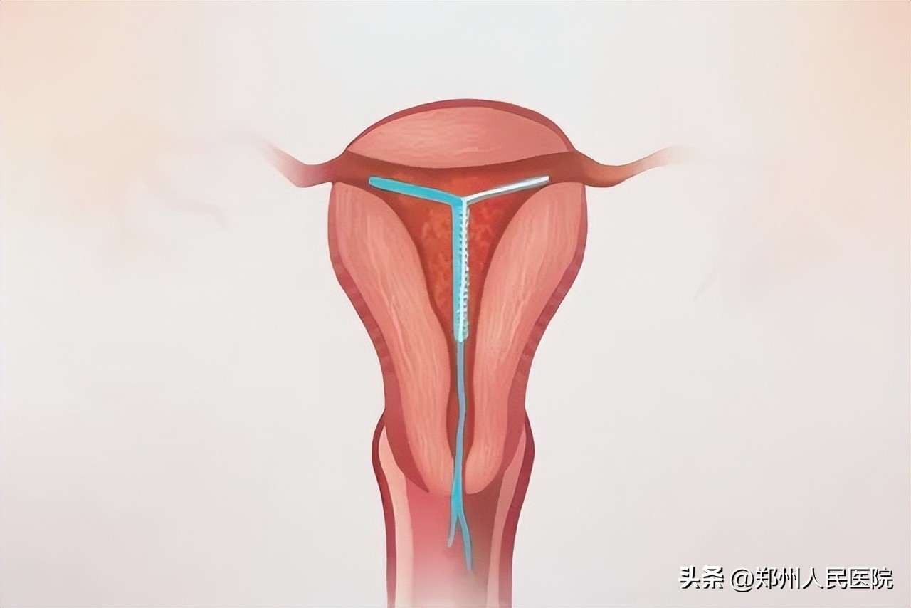 不会吧，这种话你也信？这种最不靠谱的避孕方式，我劝你别试