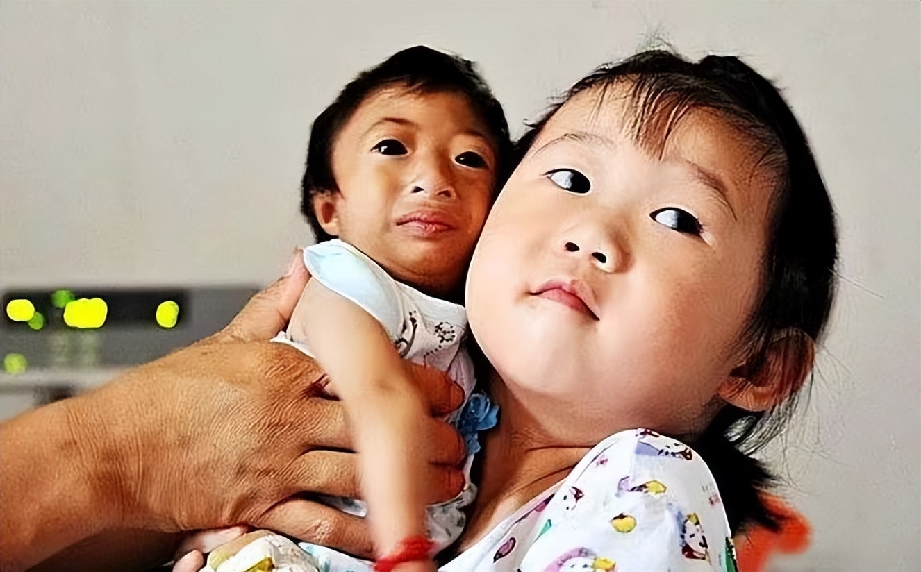 湖南生下小猴子卖给马戏团,湖南一产妇生下“小猴子”