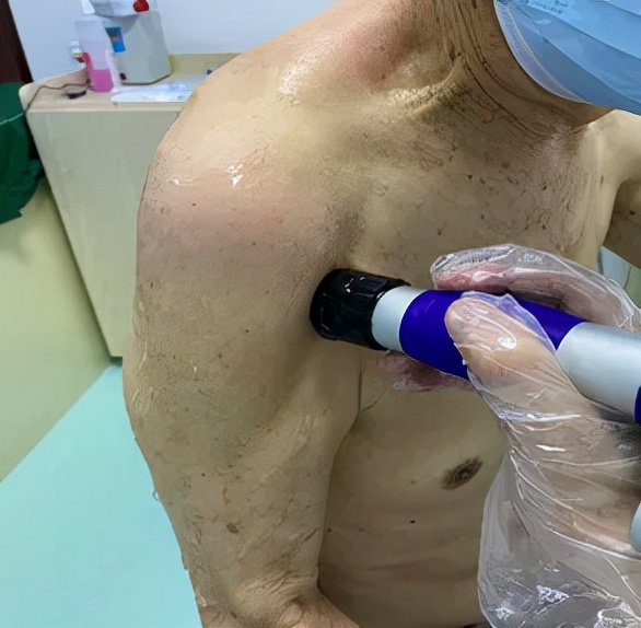 肩膀僵硬抬胳膊酸痛,肩膀肌肉僵硬紧绷疼痛怎么缓解