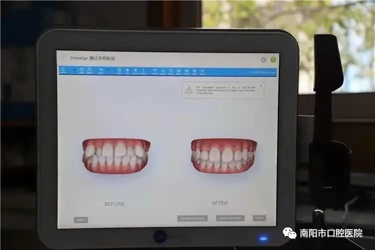 让你的牙齿变美,让牙齿变美的小技巧