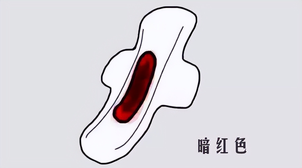 月经后总是有褐色分泌物该怎么办,为什么会月经过后有褐色分泌物