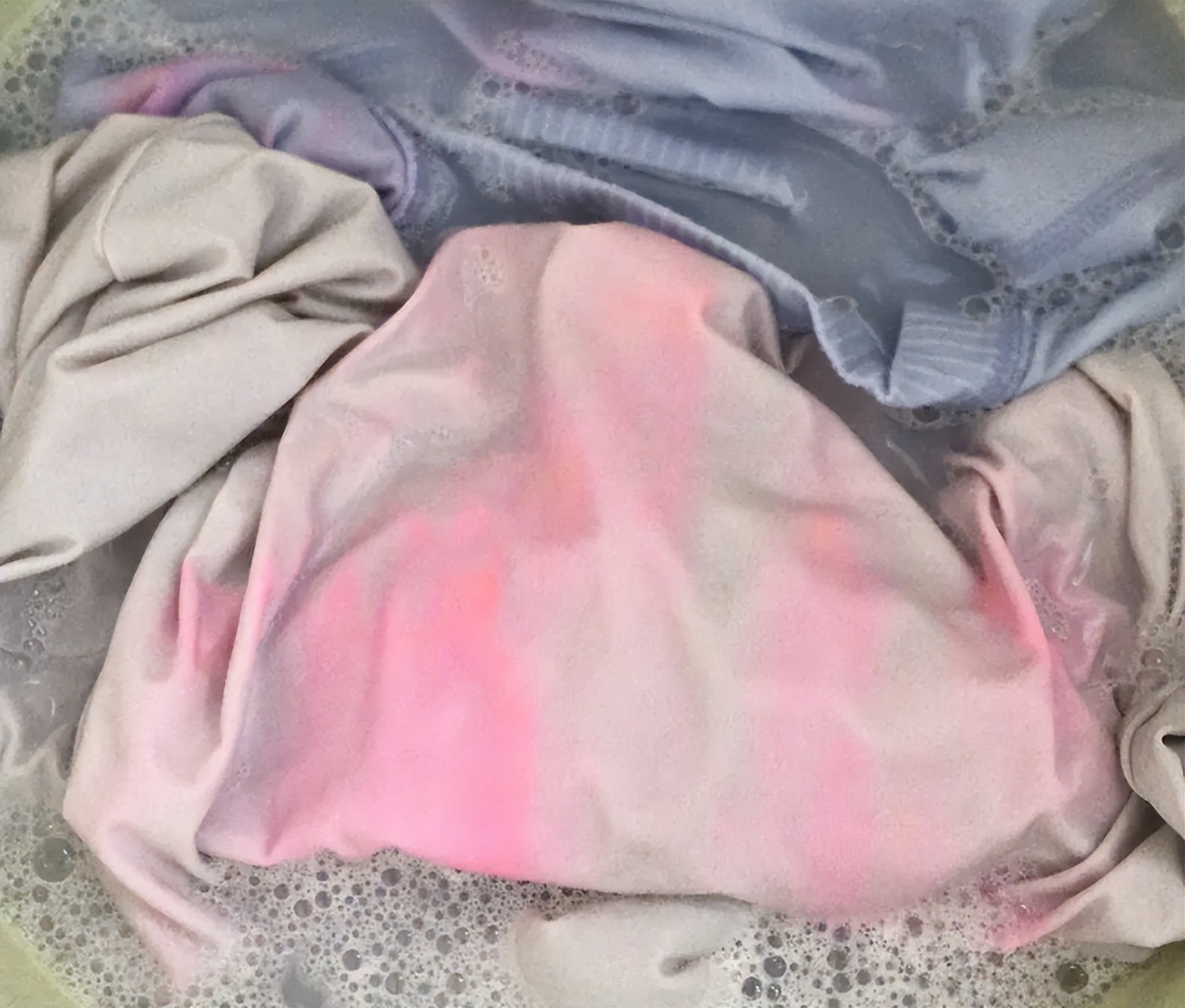 女裤总是湿湿的如何治疗,女裤上发黄有异味什么原因