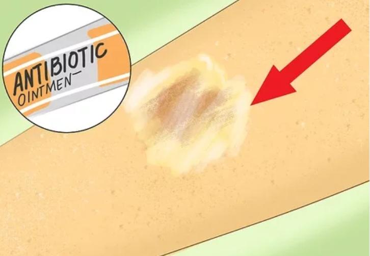 被擦伤了如何快速恢复,怎样护理伤疤