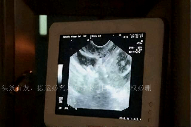 “五万一次，刺穿*体下**”：比*交性**易更恐怖的是无*交性**易