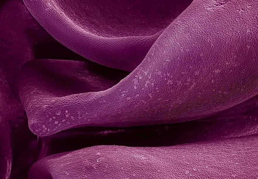 显微镜图像与真实图像,22张罕见的显微镜照片