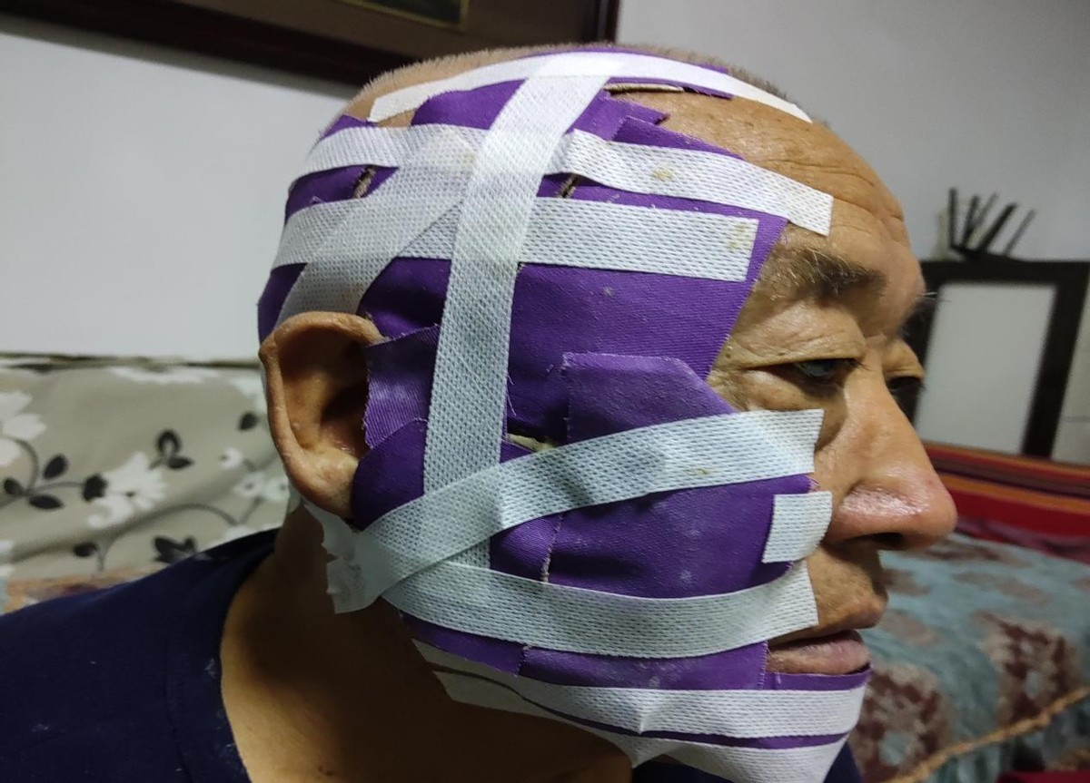 与荨麻疹抗争的经历,与痘痘抗争的每一天