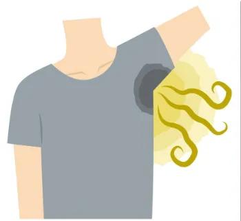 十年狐臭一招改善,狐臭治疗经验分享