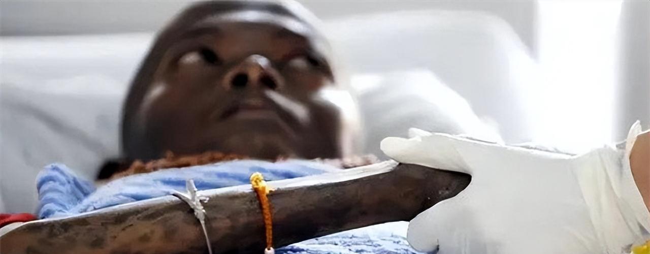 艾滋病在非洲小国肆虐，为了预防疾病，国王：女性全国不得穿裤子