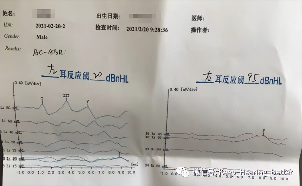 南昌大学第一附属医院鼓膜修复,南昌大学二附院耳鼻喉科专家介绍