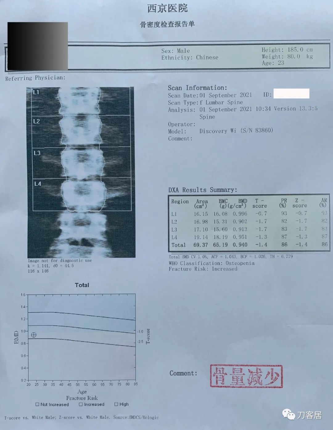 20岁出现峡部裂建议手术吗,20岁腰峡部裂了要不要手术