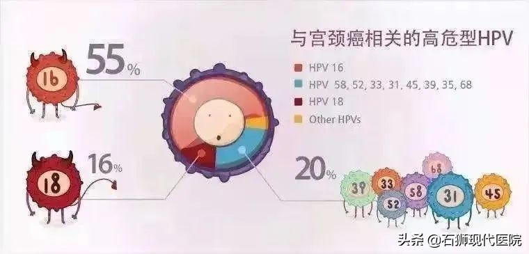 妇科体检主要查哪几项,妇科检查结果在哪里查