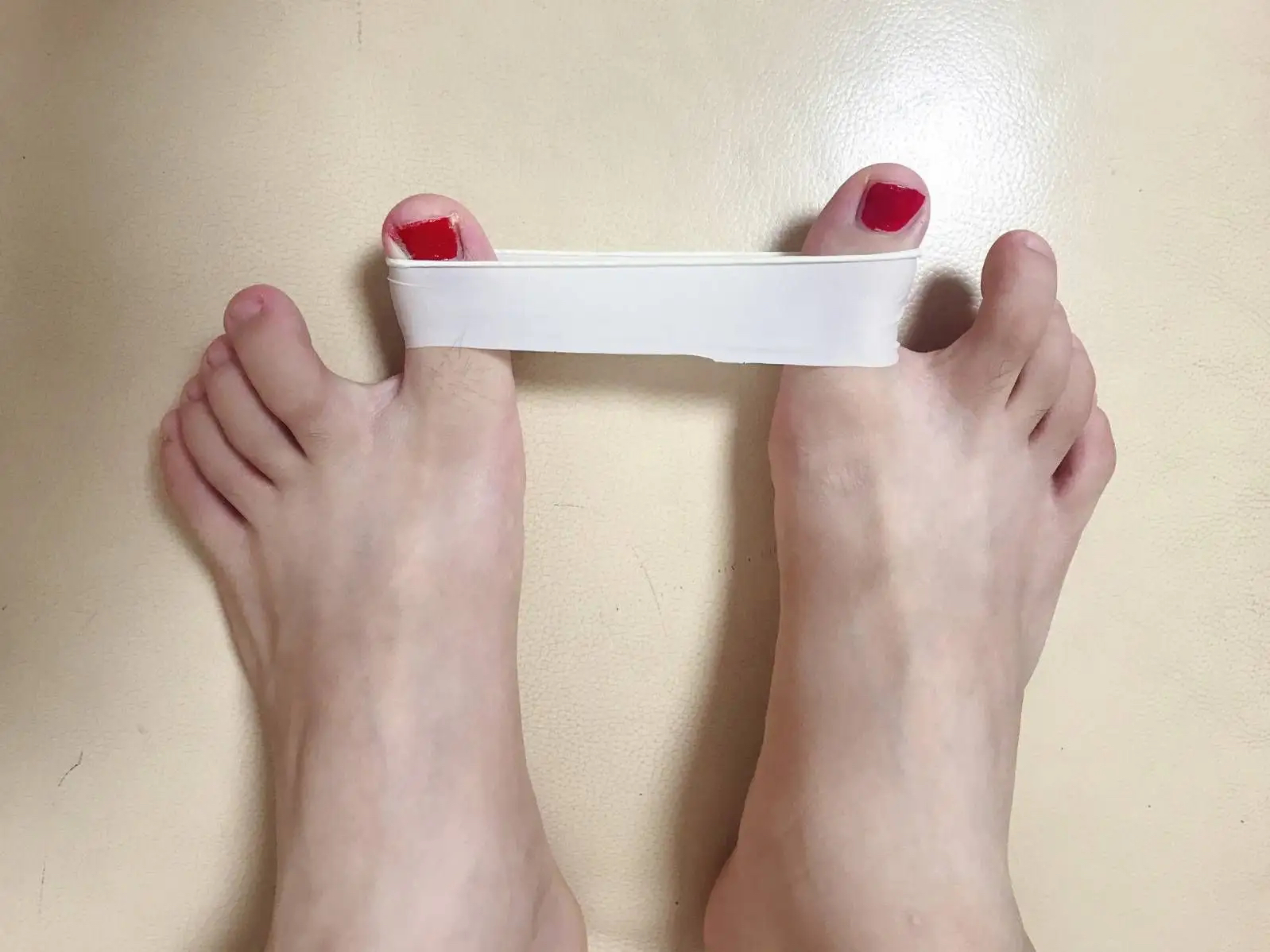 大脚拇外翻走路如何矫正,大脚趾歪了怎么矫正