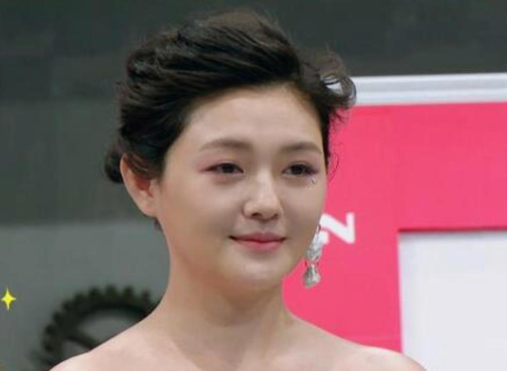 明星脸部僵硬的图片,很多明星脸僵是怎么回事