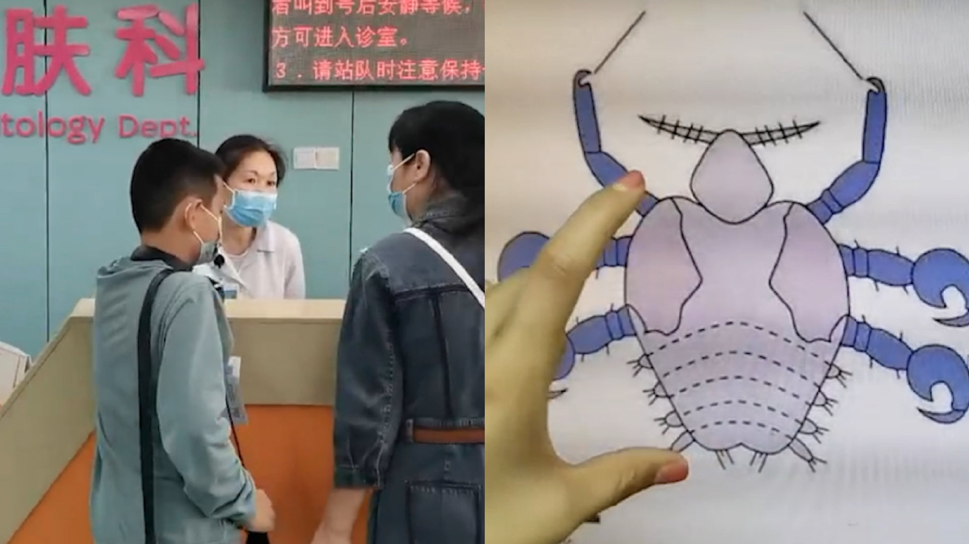 4岁男孩眼睛红肿怎么回事,12岁男孩眼睛经常肿痒怎么回事