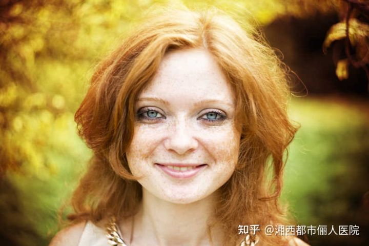 小女孩脸上长雀斑怎么回事？吉首俪人告诉您
