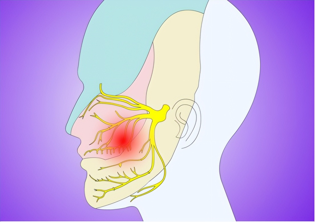 面肌痉挛会不从眼皮开始发病吗,什么是面肌痉挛该如何治疗