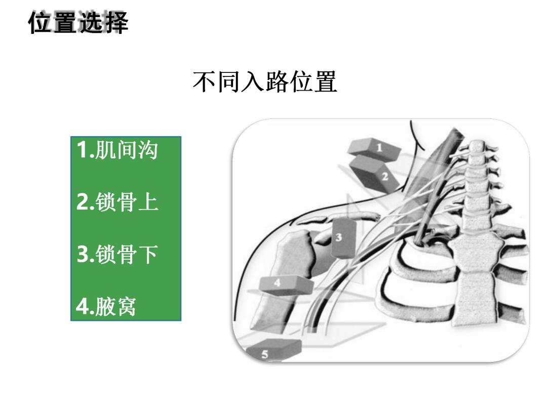 超声引导下臂丛神经阻滞,PPT课件