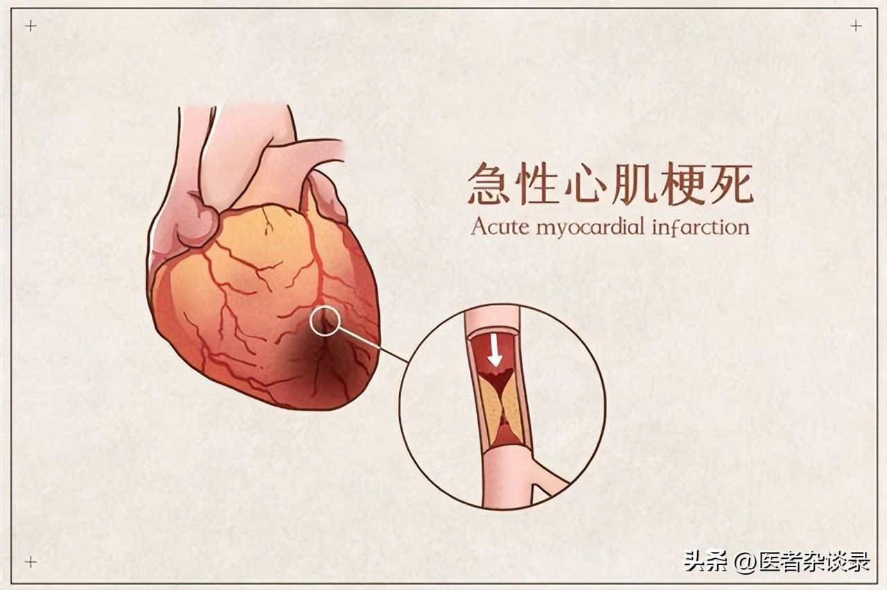 男子因腰痛入院,男子受伤住院