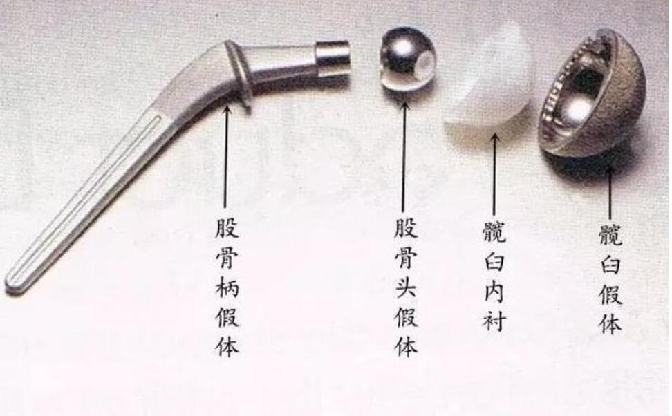 股骨颈骨折矫正仪器,骨科机器人好用吗