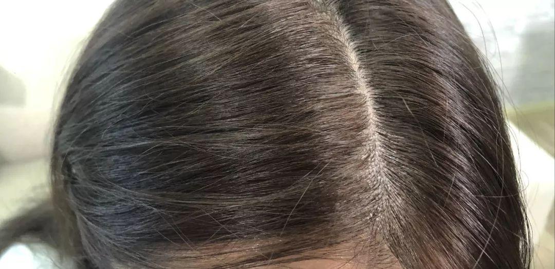 比清扬飘柔海飞丝好的洗发水,海飞丝和清扬哪个洗发水更好