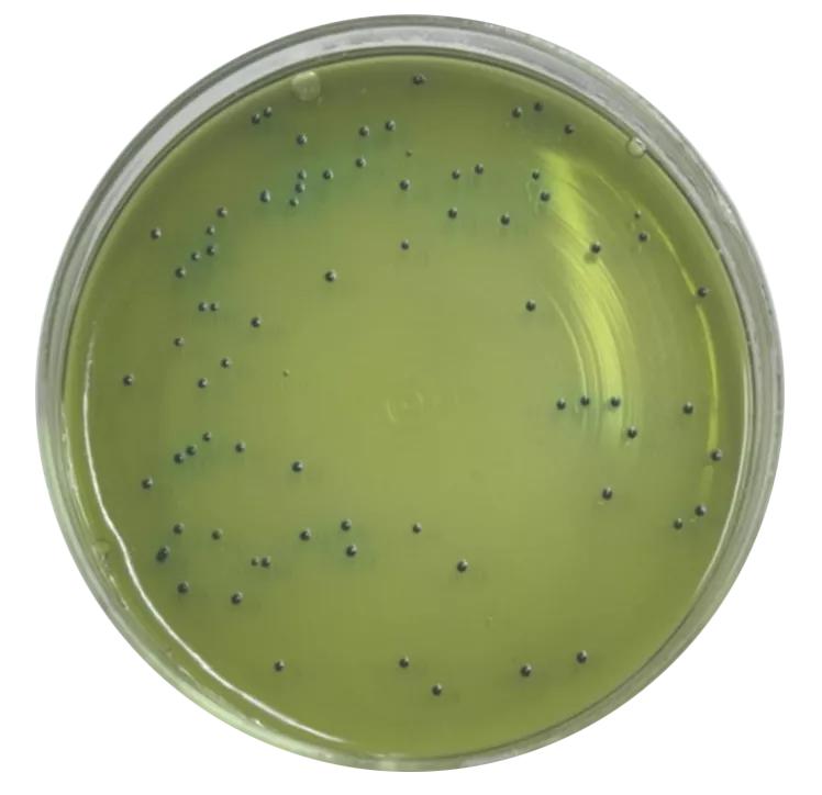 食品微生物沙门菌检验流程,食品中沙门氏菌的检测视频