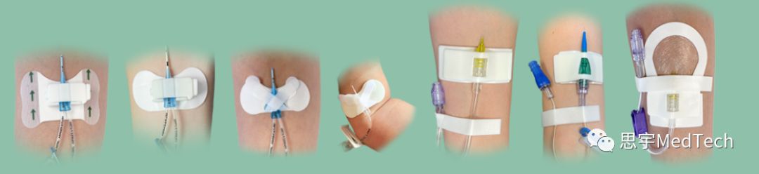 贝朗血液透析机耗材,贝朗输液器耗材有哪些