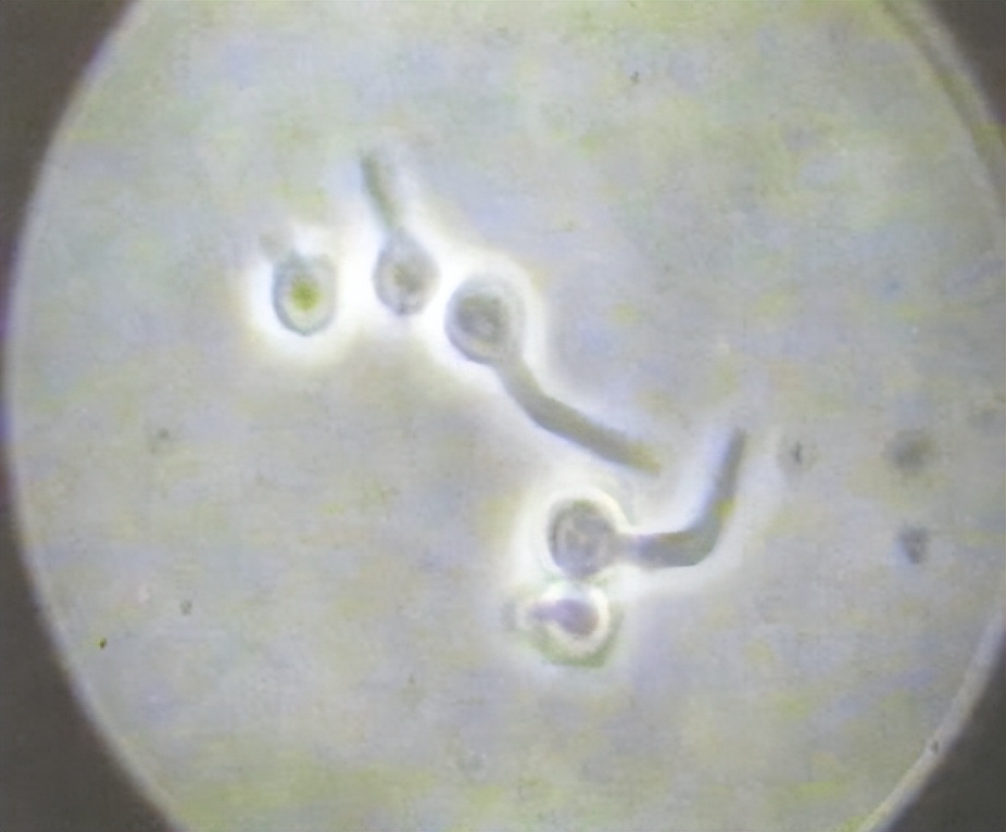 金黄色葡萄球菌的微生物特性,金黄色葡萄球菌的培养特性