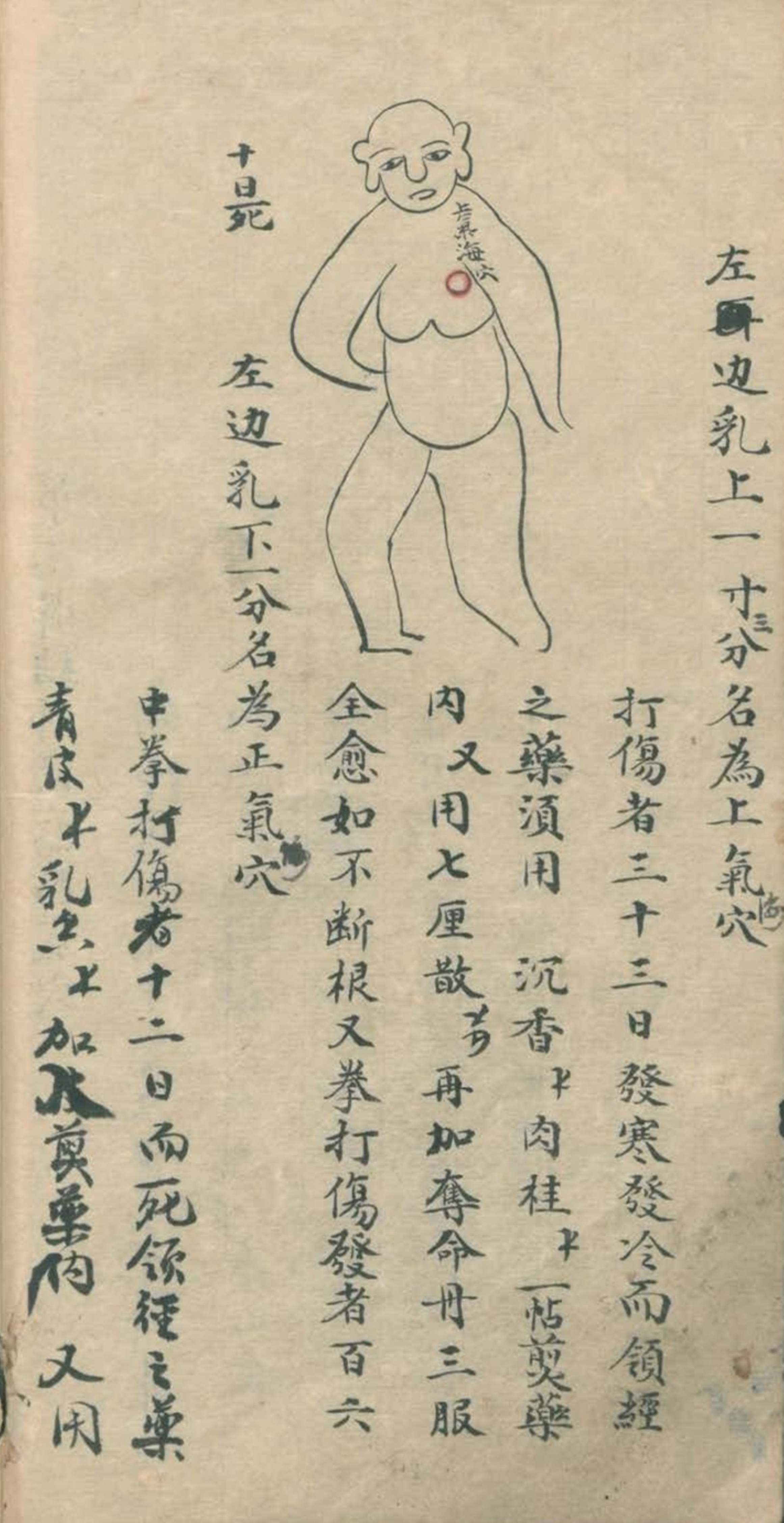 最实用的跌打药方,祖传跌打秘方100首