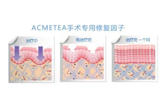 什么牌子的水光针好用不伤皮肤,现在哪种水光针比较好
