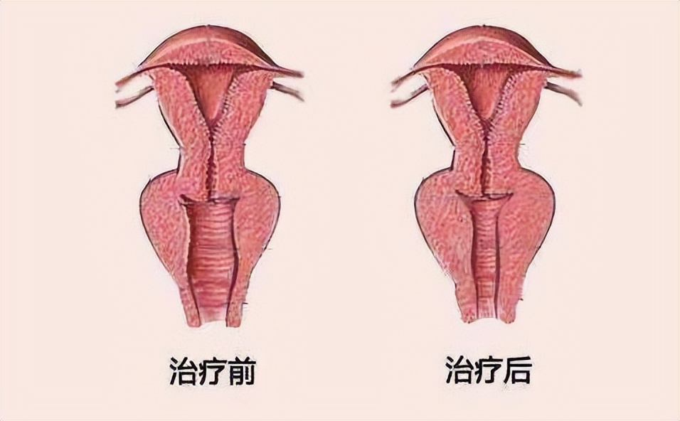 现实生活中女性要警惕七种阴道炎,女性要小心9种阴道炎