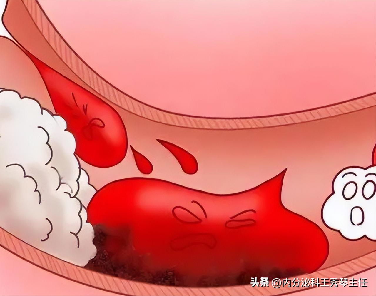 肾病治疗过程中，常用的药有哪些