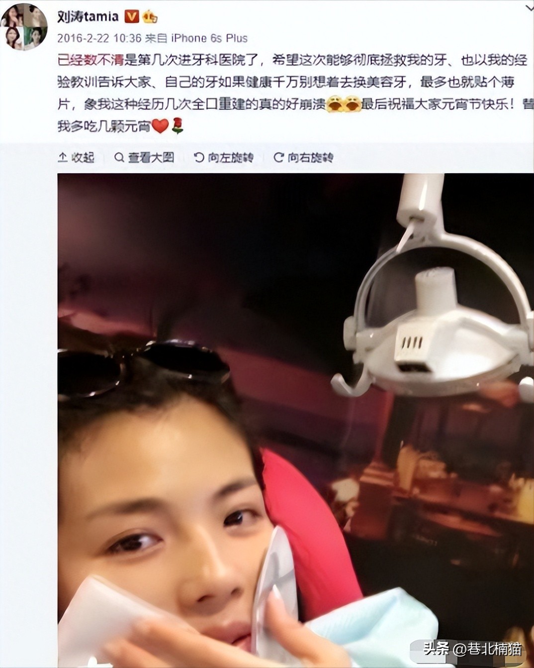 明星嘴突戴牙套前后对比,明星和假牙