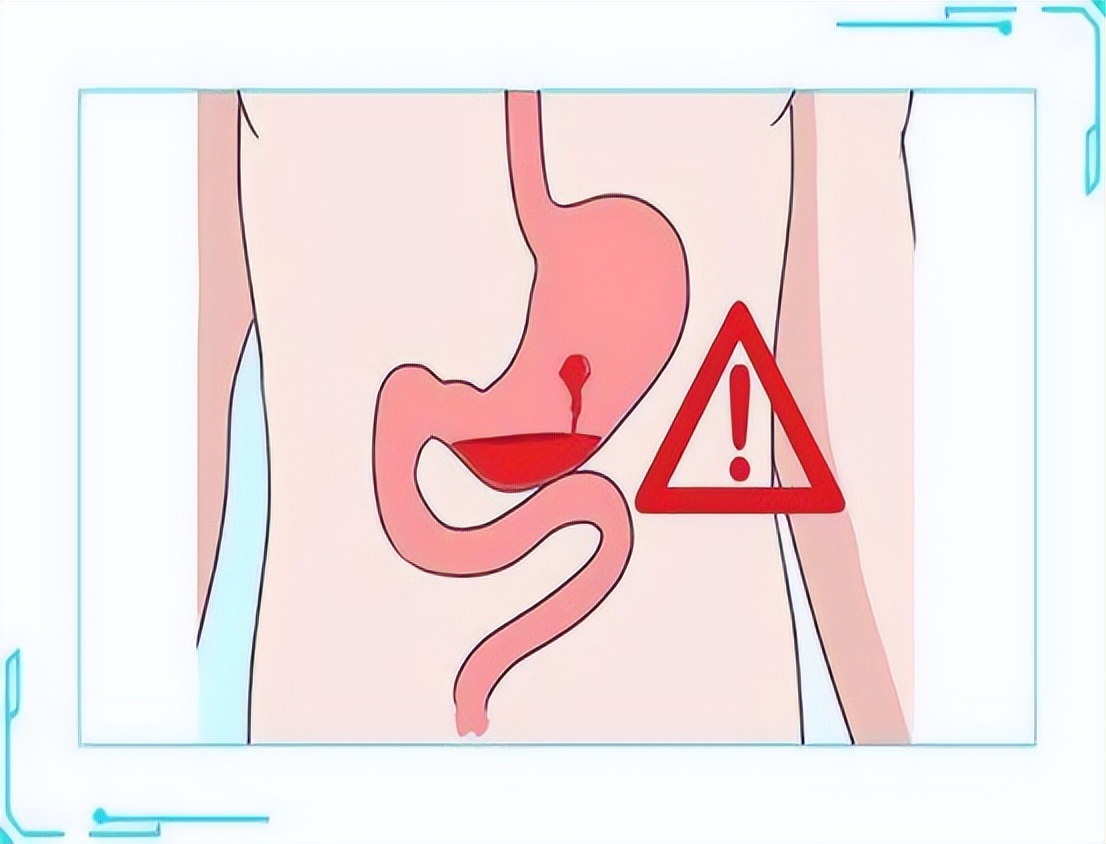 氯吡格雷可以长期替代阿司匹林吗,阿司匹林和氯吡格雷有替代品吗