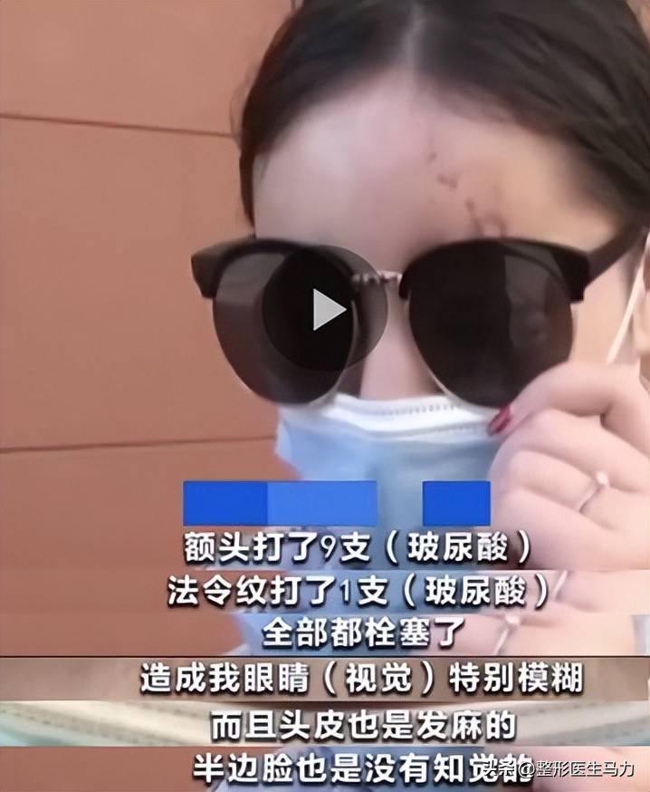 鼻基底玻尿酸栓塞后续治疗方法,鼻基底打玻尿酸栓塞后打溶解酶