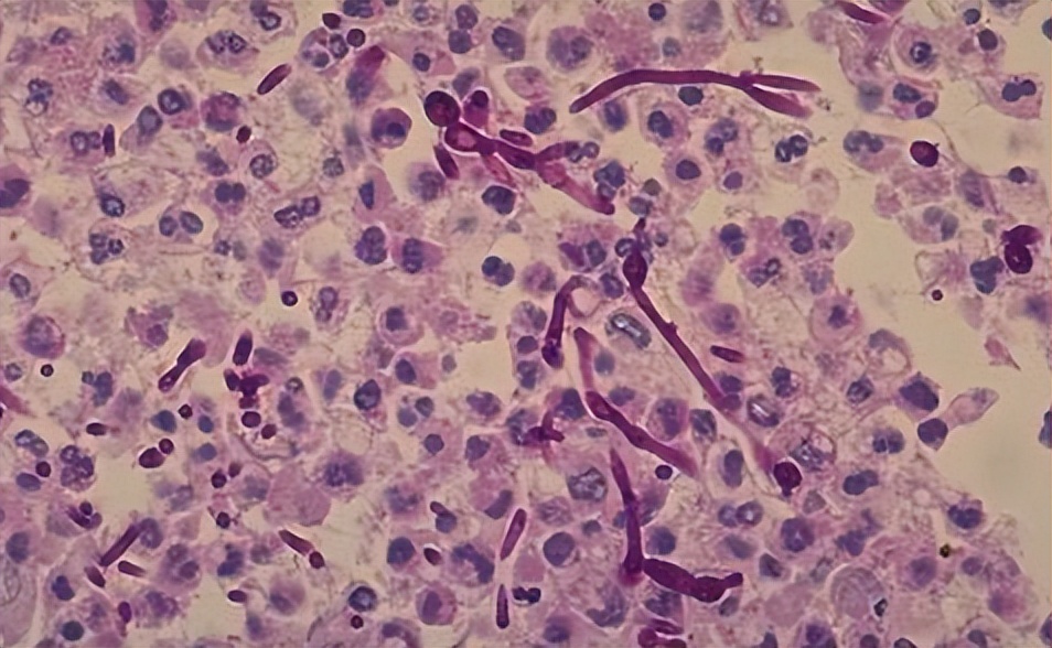 常吃酵母蒸的馒头，会危害健康吗？为了家人的健康，不妨了解一下